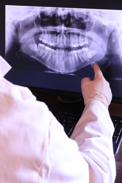 Best Emergency Dentist for Lost Fillings or Crowns in Coal Fork, WV