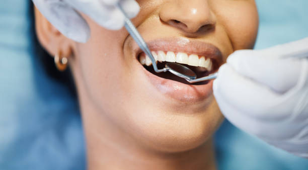 Best Emergency Dental Care for Abscessed Tooth in Coal Fork, WV